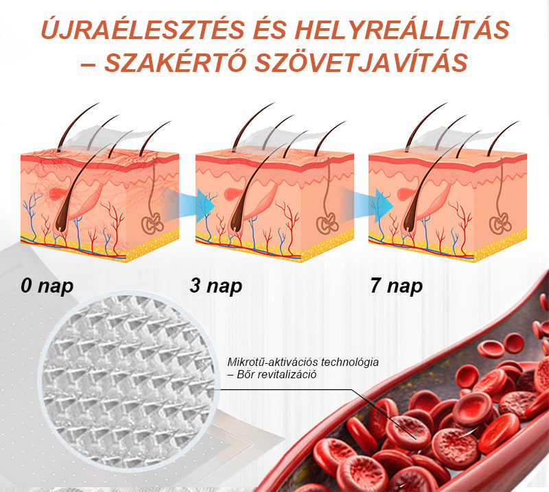 CleraNaure® Vein Ease Mikrotűs Kezelő Pecsét (Pókháló Vénák, Visszér, Duzzanat és Lábfáradtság Ellen)