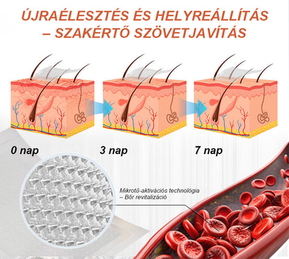 CleraNaure® Vein Ease Mikrotűs Kezelő Pecsét (Pókháló Vénák, Visszér, Duzzanat és Lábfáradtság Ellen)