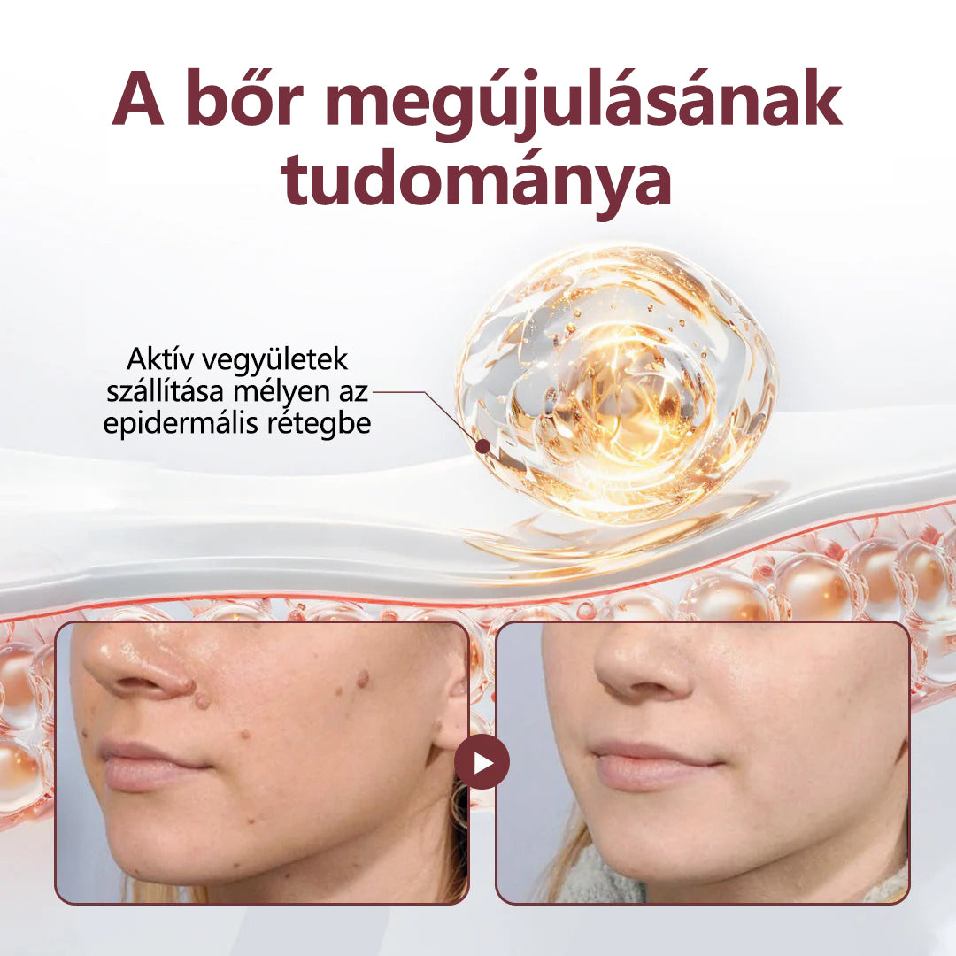 ⭐Hivatalos áruház👨‍⚕️ CleraNaure® KeraErase - Kettős hatású bőrfiatalító krém 👨‍⚕️ (Kettős hatású fiatalítás – simítja a kiemelkedő dudorokat és lebontja a mélyen lerakódott keratint savak és irritáció nélkül
