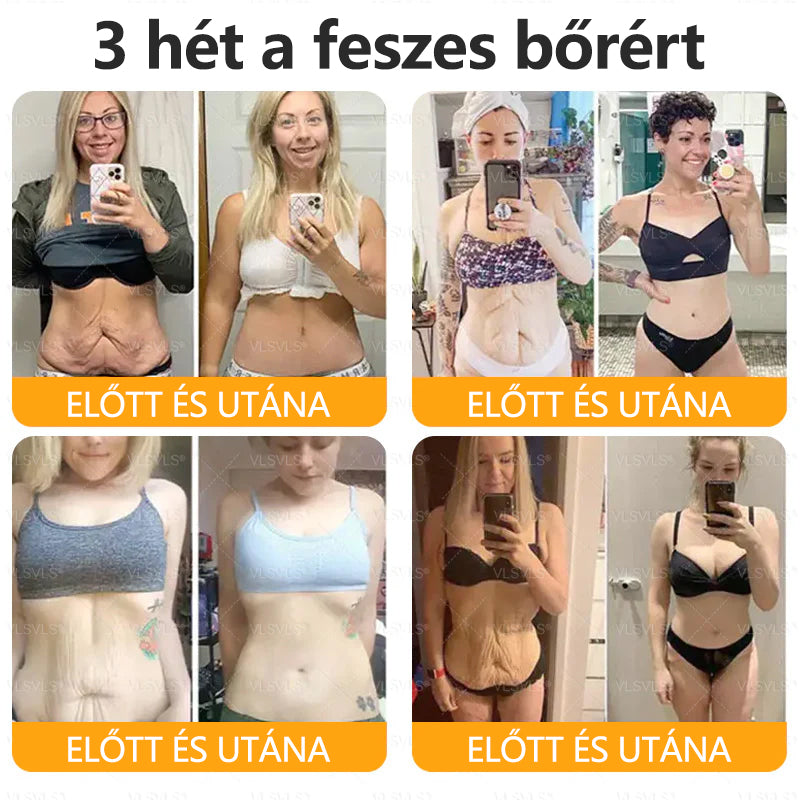 ✨CleraNaure® Méhméreg Bőrregeneráló Krém✨