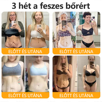 ✨CleraNaure® Méhméreg Bőrregeneráló Krém✨